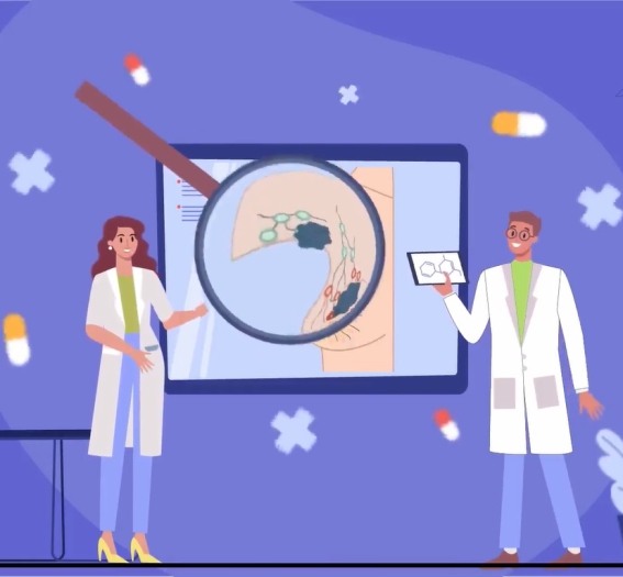 موشن گرافی سرطان پستان